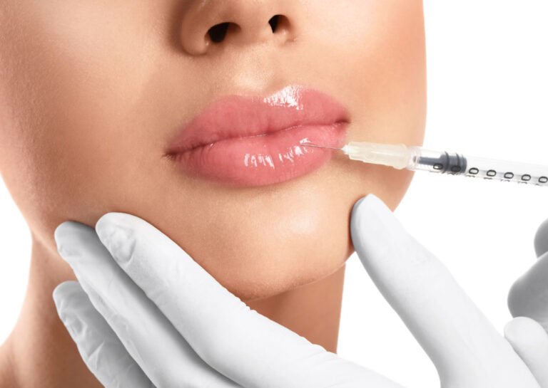 Lip Fillers from Medical Professional